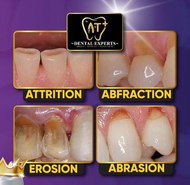 Slider image (8) Dr. A & T Dental Experts